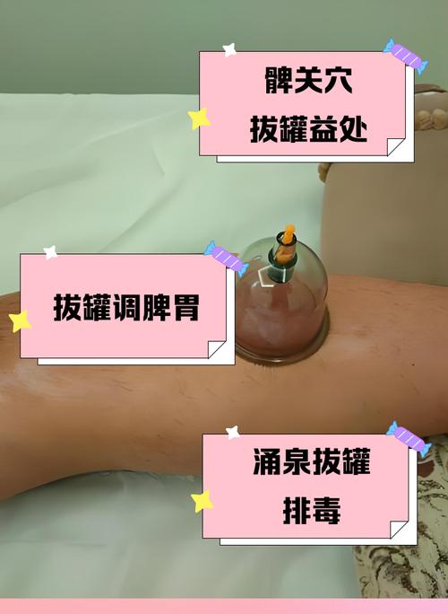 膝盖风湿拔火罐位置图