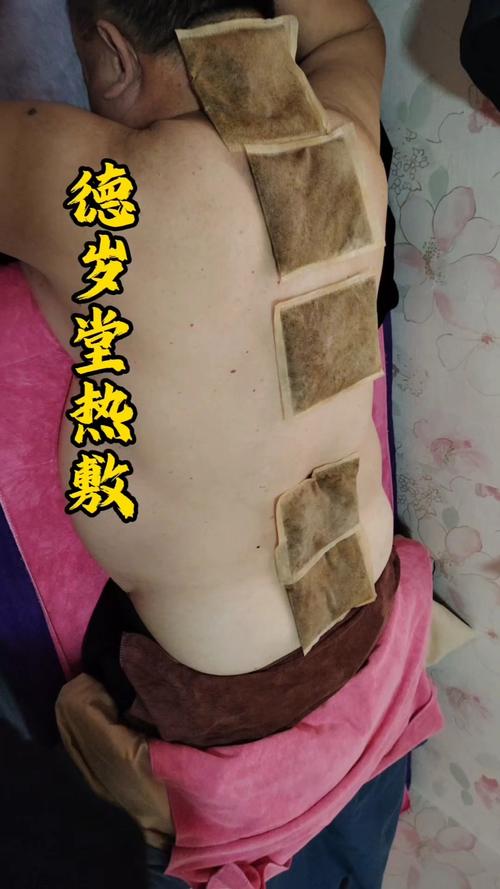 穴位热敷现象有哪些