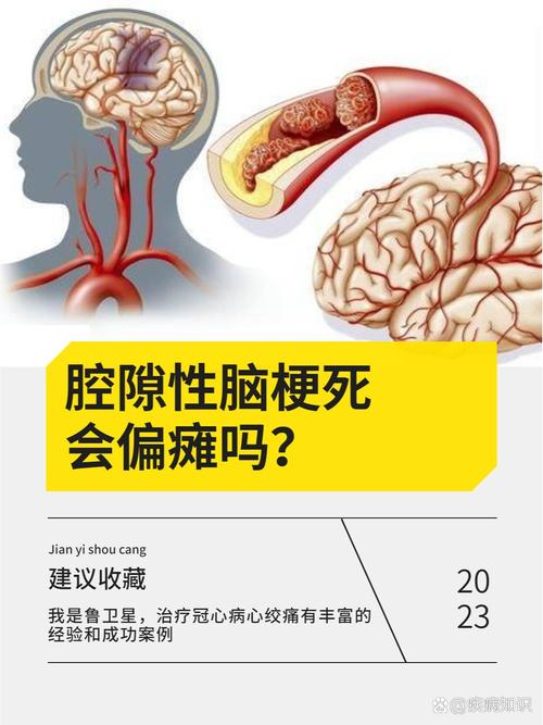 腔隙性脑梗是什么意思