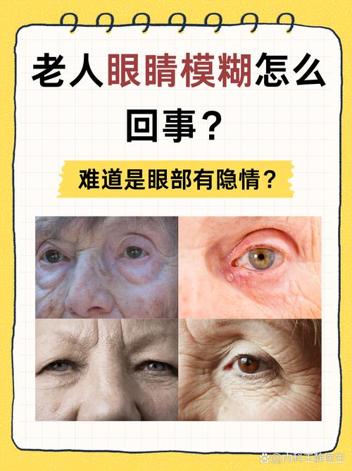 脑梗会引起眼睛模糊吗