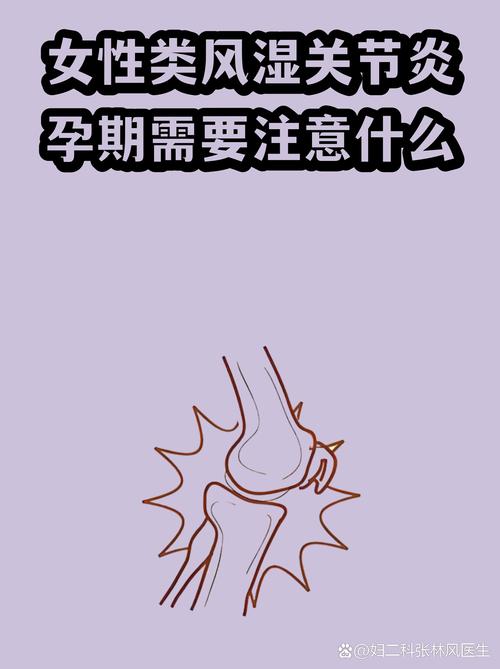 怀孕会不会类风湿减轻