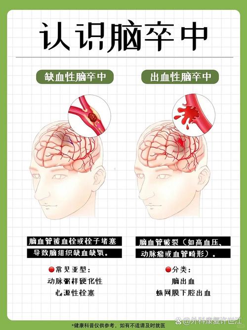 脑梗形成的原因有哪些