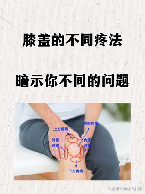 风湿膝盖疼的治疗方法