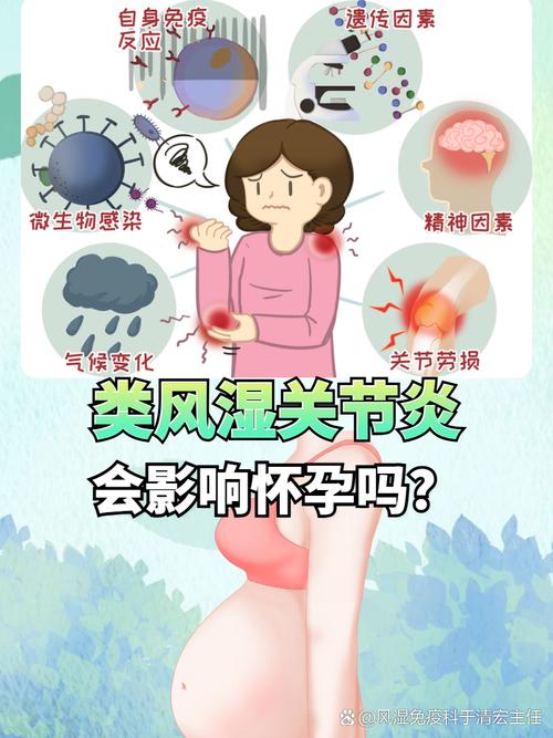 风湿怀孕有什么影响吗