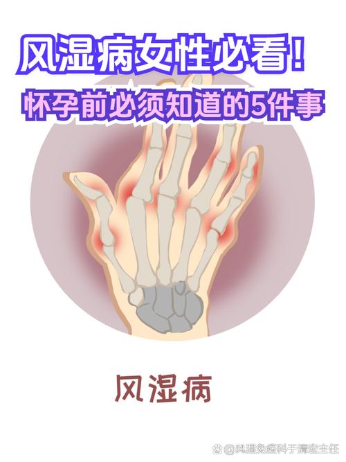 风湿怀孕有什么影响吗