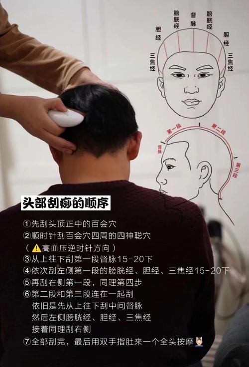 预防中风 头部穴位