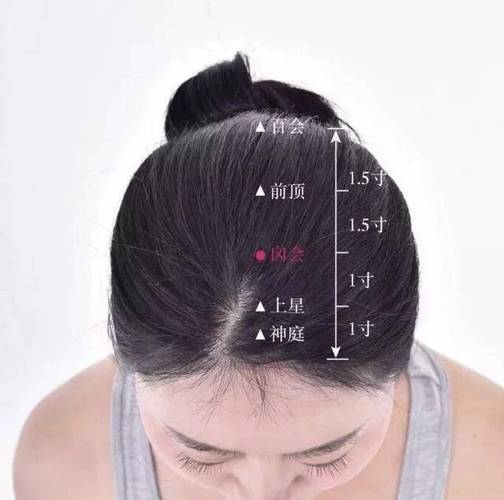 预防中风 头部穴位