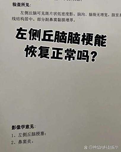 丘脑脑梗能恢复正常吗