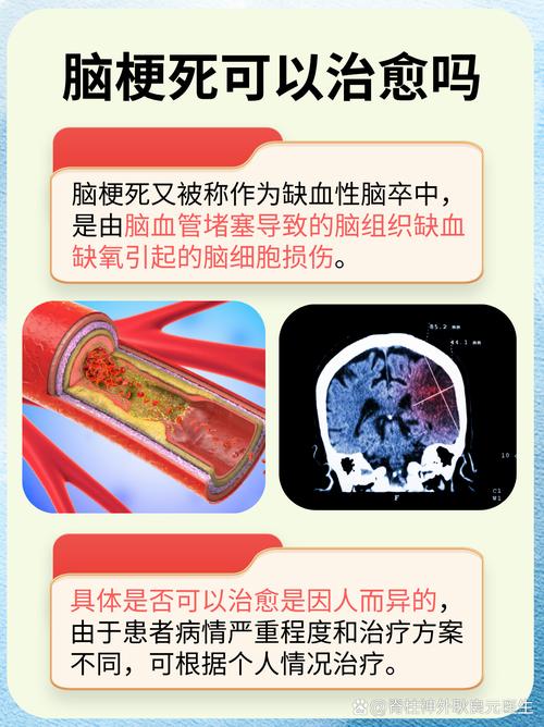 脑梗有没有治愈的可能