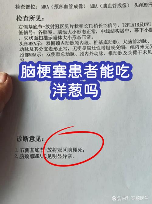 那些蔬菜对脑梗有益