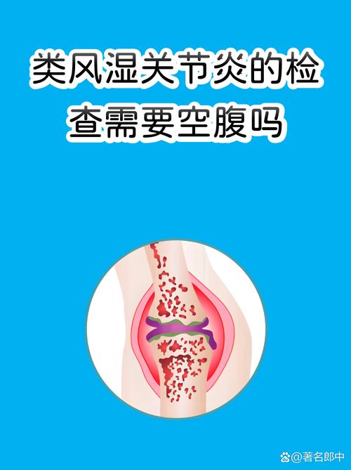 类风湿查血需要空腹吗