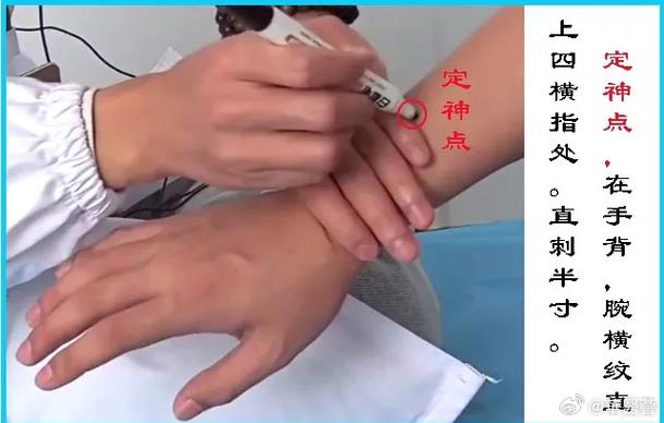 帕金森按摩穴位疗法