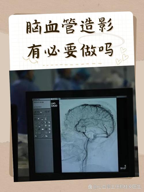 脑梗血管造影是手术